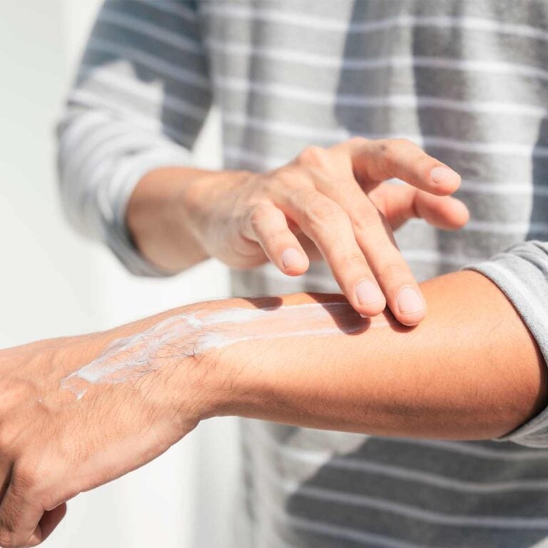 Hombre aplicando crema corporal Labnatur sobre el brazo para hidratar y suavizar la piel.