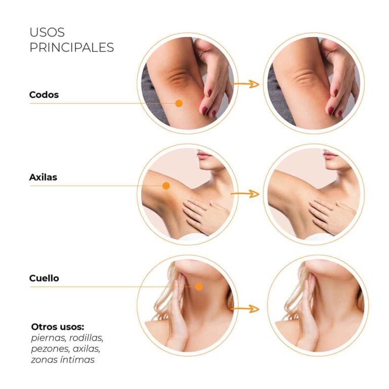 Usos principales de la Crema Blanqueadora Corporal-Facial Labnatur en codos, axilas, cuello y otras zonas del cuerpo.